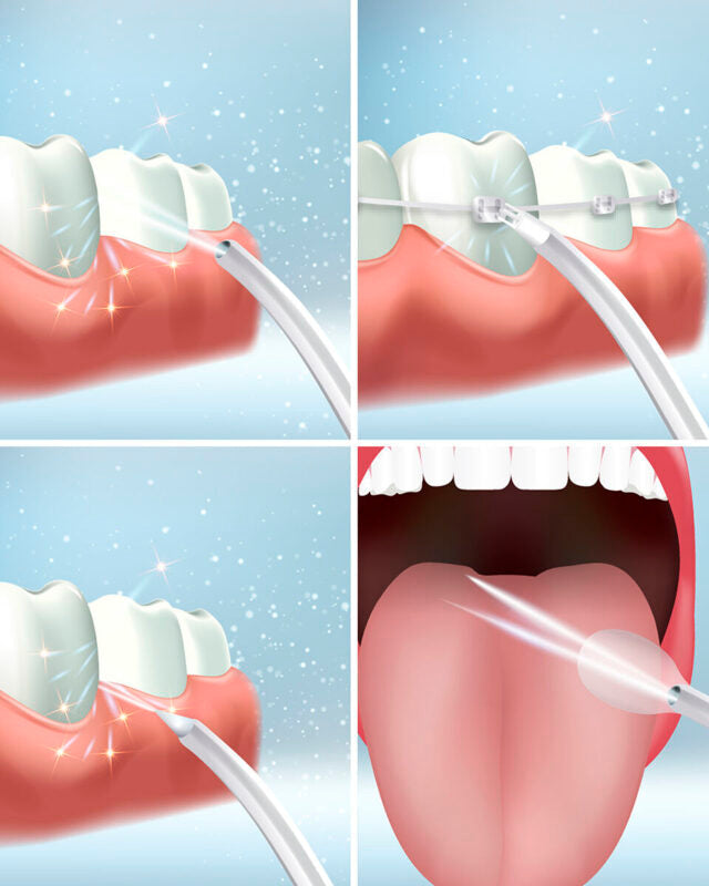 OralFlow – Idropulsore Dentale Portatile Ricaricabile